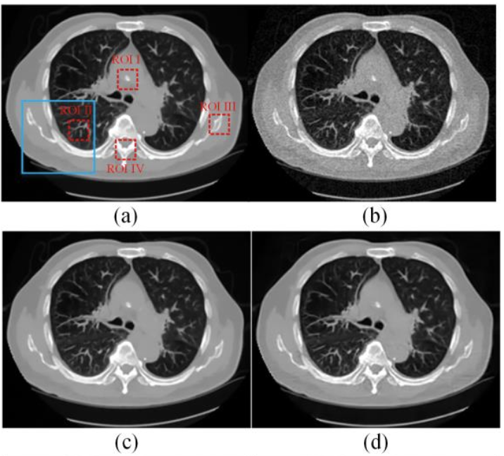 Medical Image Super Resolution